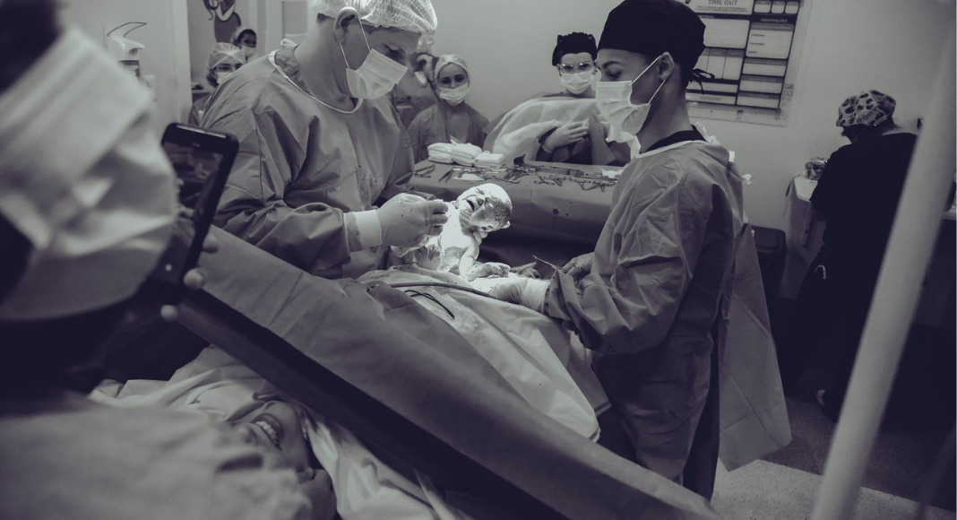 A woman giving giving birth by C-section (Covid-19, Labor & Visitation: What You Need to Know Dianna Hill Contributor Miami Mom Collective)