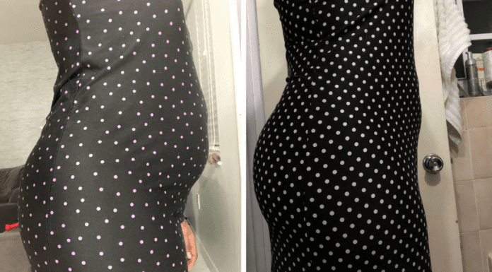 Before and after pictures of a woman in a polka dot dress (Group Fitness Training: 3 Things I Learned When I Joined Janeris Marte Contributor Miami Mom Collective)