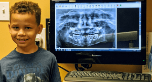 A pediatric dental patient pictured next to one of his x-rays