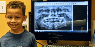 A pediatric dental patient pictured next to one of his x-rays