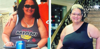 Image: Natasha getting around in a scooter, versus the active woman she is today