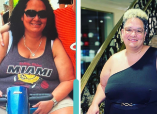 Image: Natasha getting around in a scooter, versus the active woman she is today