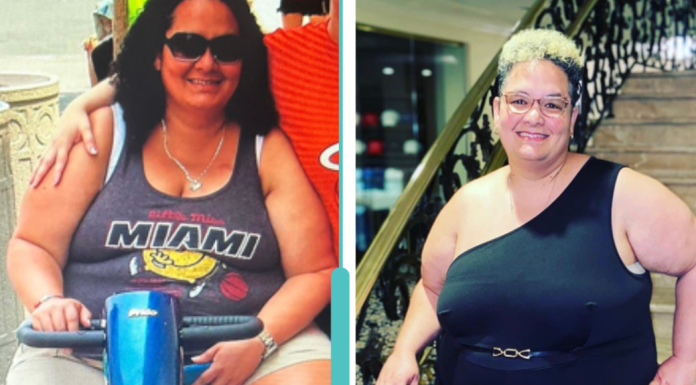 Image: Natasha getting around in a scooter, versus the active woman she is today